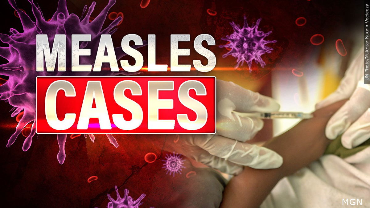 Montana sees first Measles cases in over 30 years