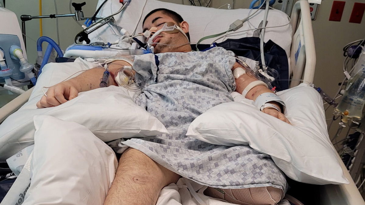 Disabled teen shot in Pocatello officer-involved shooting fighting for his life in a coma