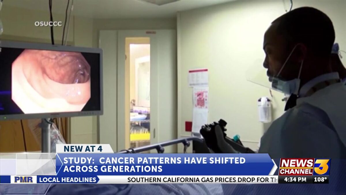 New study shows shifting patterns in rectal cancer over different generations