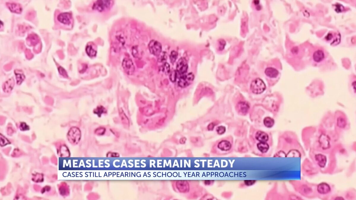 Measles cases remain steady as new school year approaches