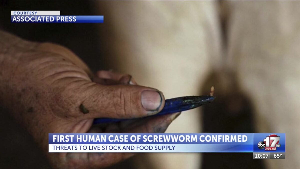First human case of screwworm adds to concerns over livestock and beef costs