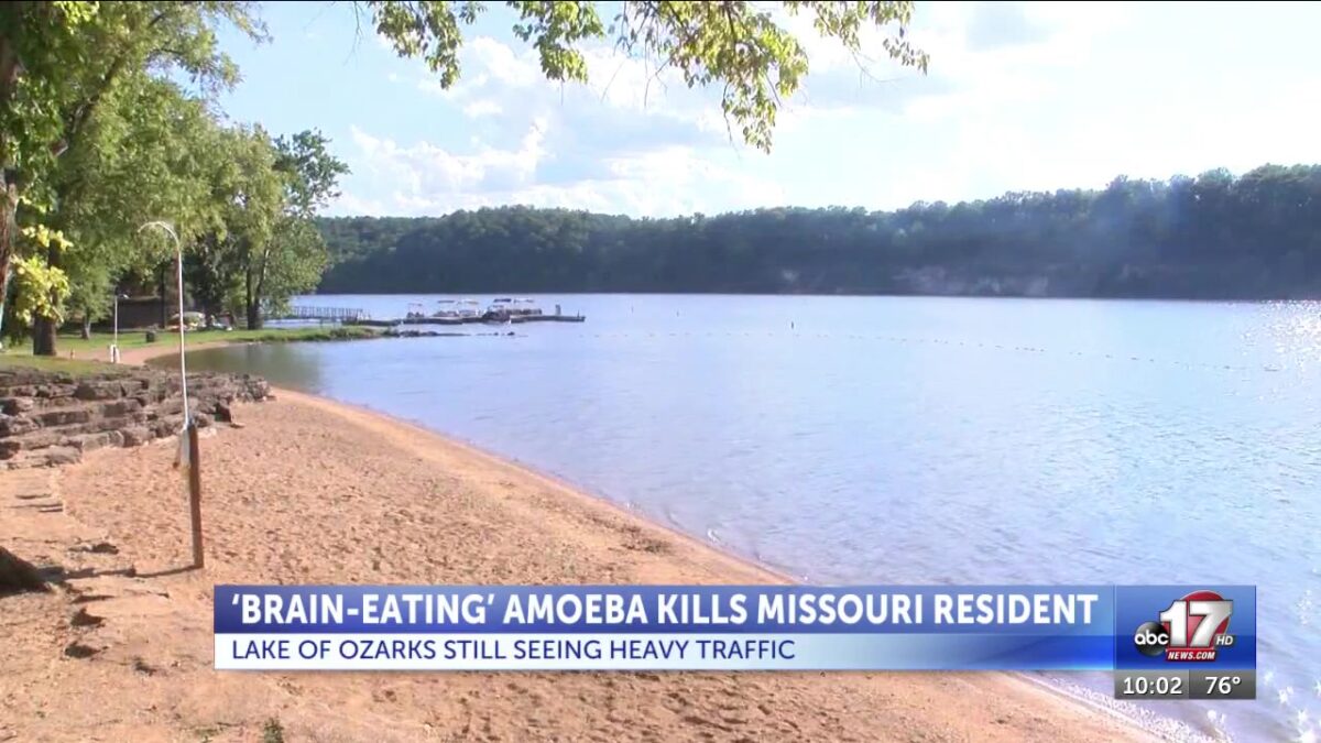 ‘Brain-eating’ amoeba kills Missouri resident after Lake of the Ozarks trip