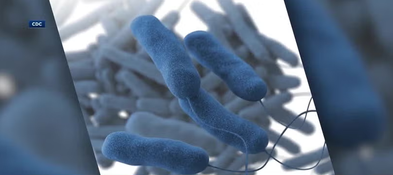 There have been 34 confirmed cases of Legionnaires' disease