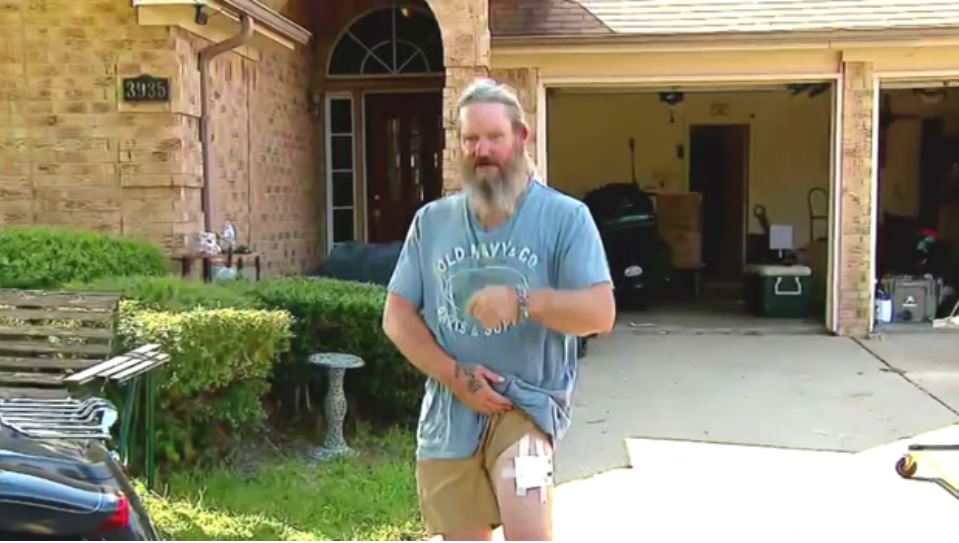 A Grand Prairie man says police shot him after he opened his garage door to what he believed were burglars — only to discover officers had mistakenly arrived at his home due to a 911 dispatch error.