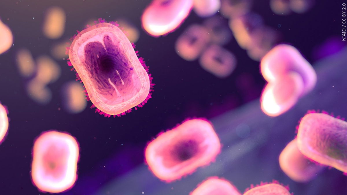 Mpox detected in Riverside County resident who returned from international trip