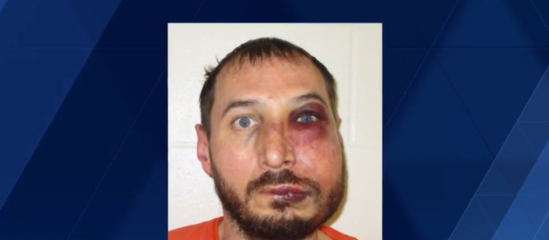 Justin Savage claims he was unlawfully assaulted and beaten by Maine State Police troopers who arrested him last year