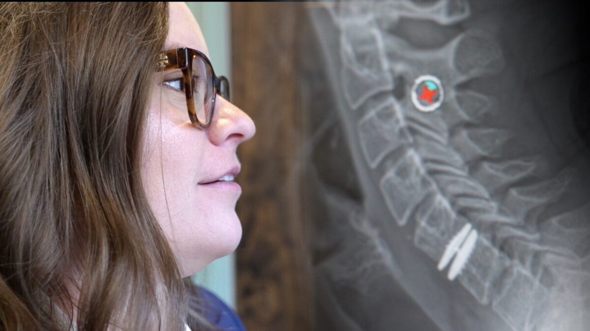 Emily Robbins was 29 years old when she had surgery for a herniated disc. She is sharing her story because she says there is a stigma about back and neck surgery — especially for younger people.
