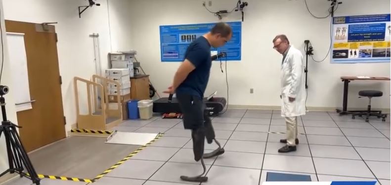 Ross Holland discovered a unique way to wear his prosthetic legs by turning the feet backward.