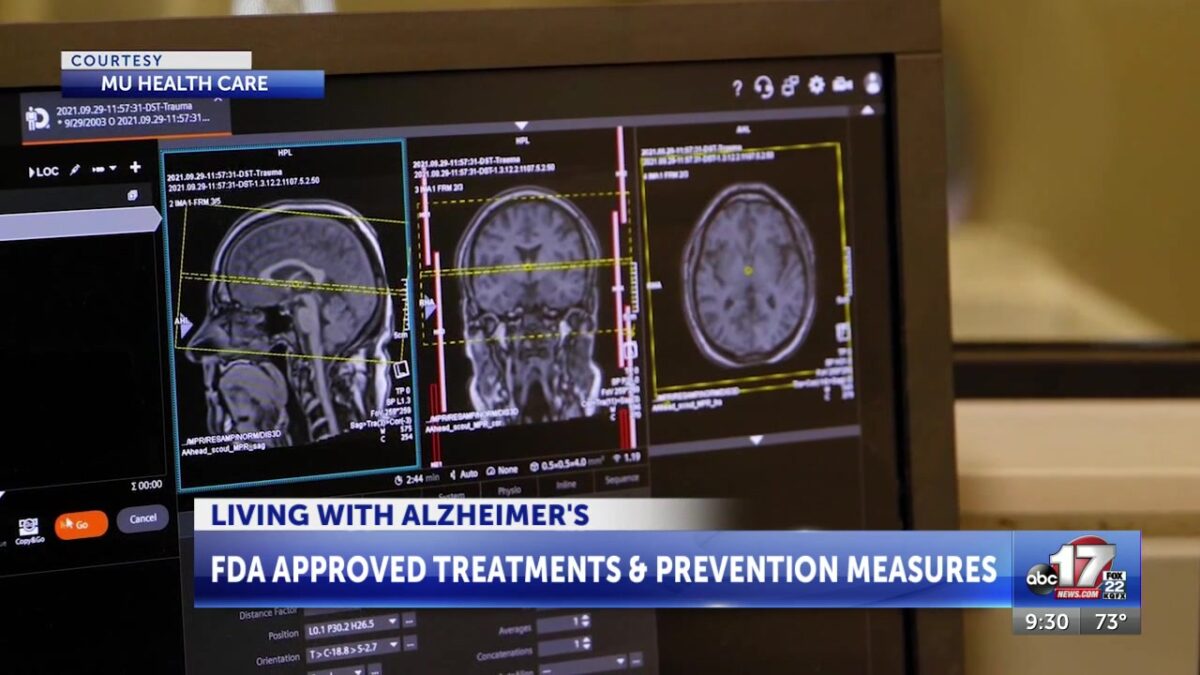 Alzheimer’s research advancing with treatments and prevention