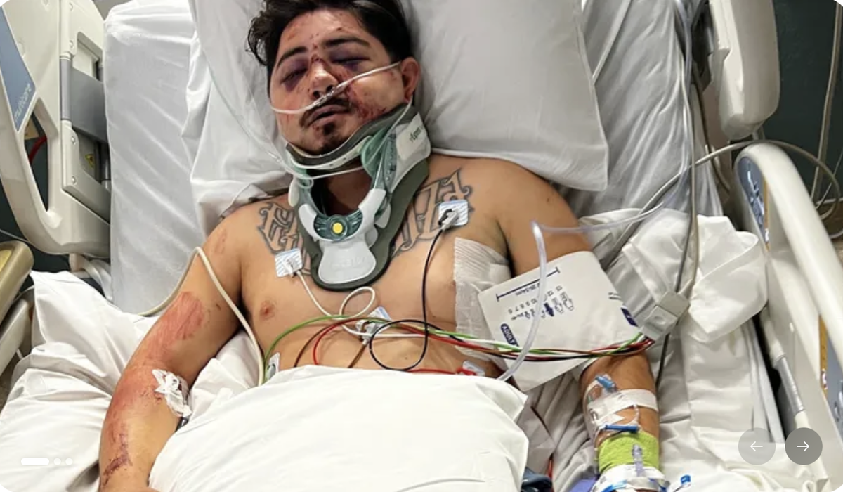 Father hospitalized with serious injuries after severe car crash