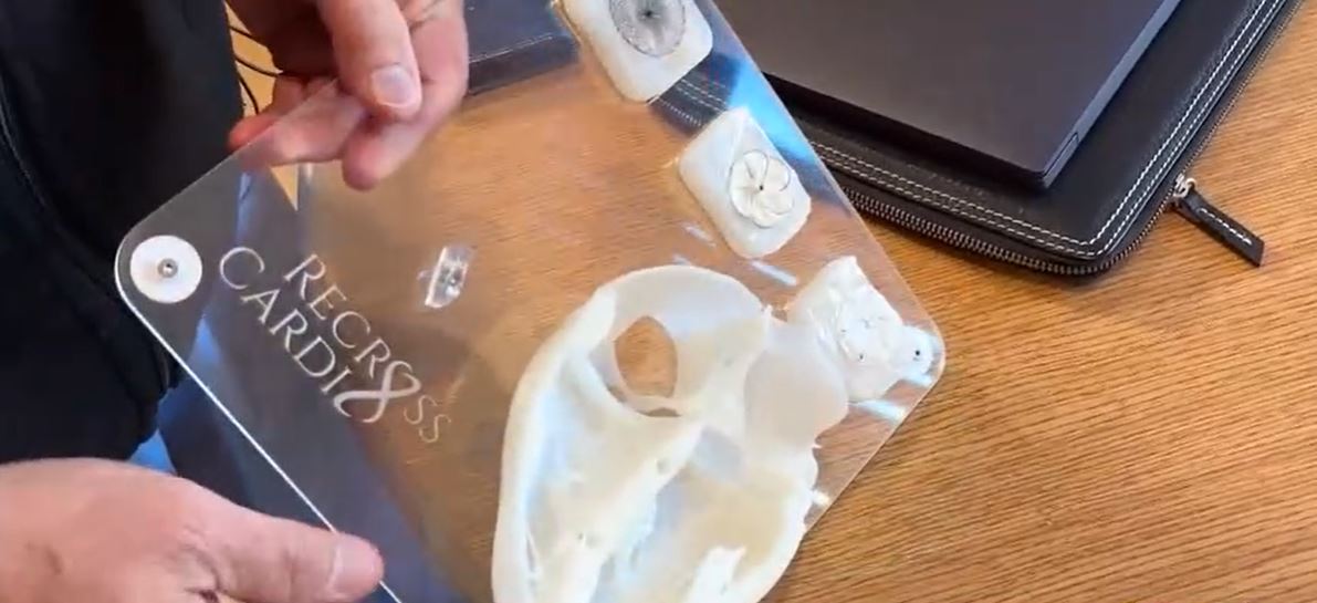 A breakthrough treatment is giving a Boston man a new lease on life after suffering a stroke at just 29 years old.