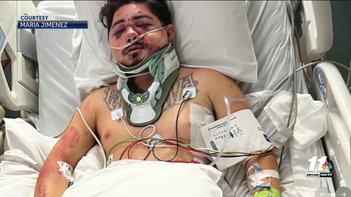 Father hospitalized with serious injuries after severe car crash