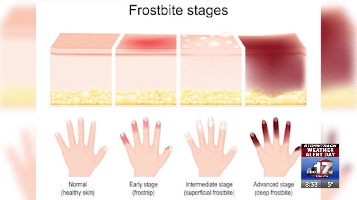 Negative windchills raises risk of frostbite across Mid Missouri Sunday