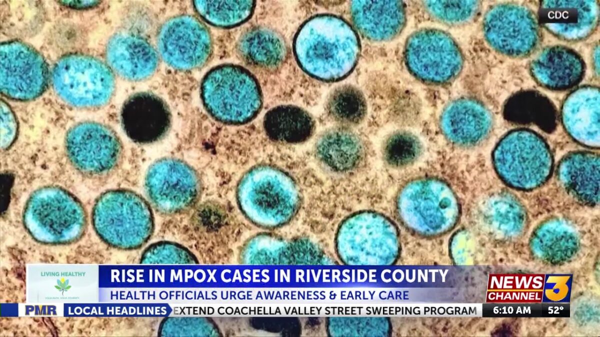 Riverside County Reports Slight Increase in MPOX