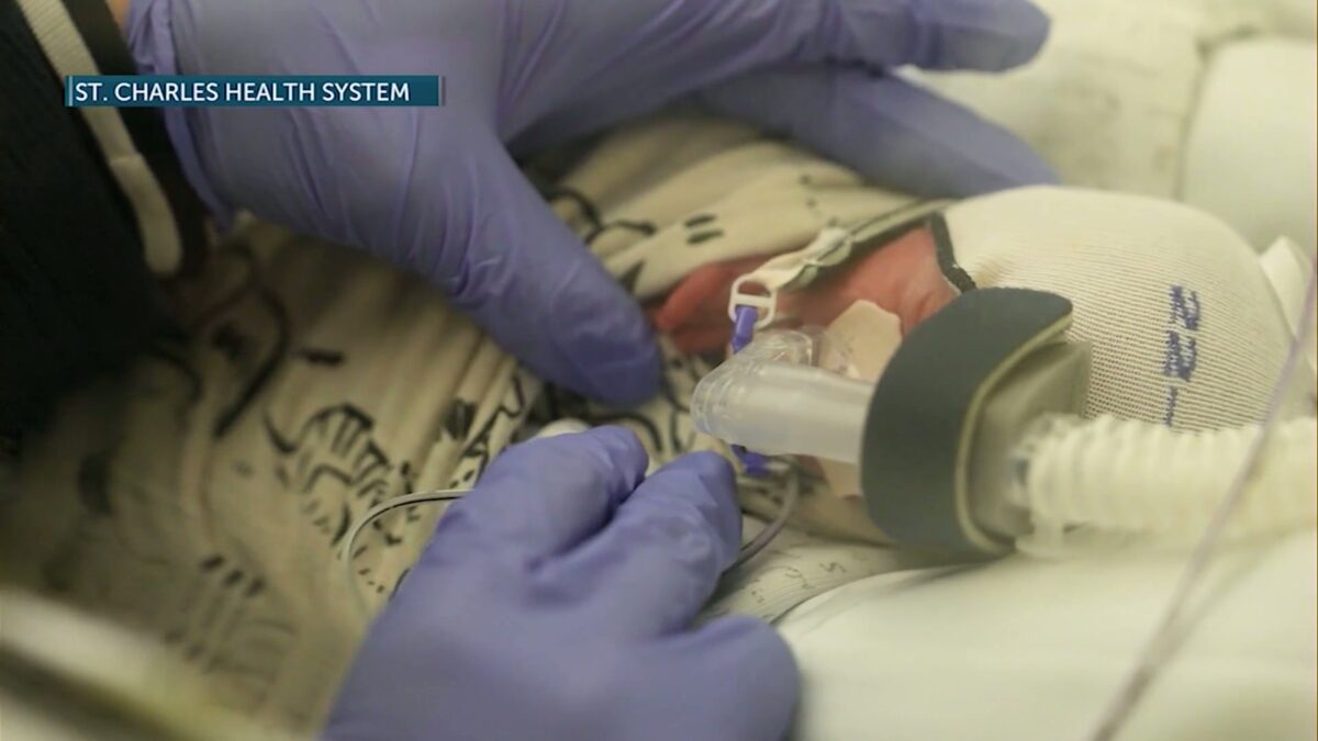 ‘Things just got better’: New technology helps preemies breathe easier at St. Charles
