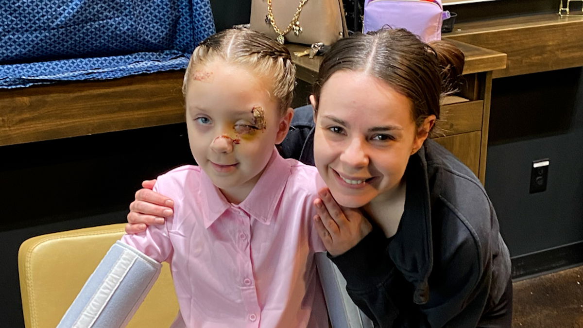 Girl injured in NYE fireworks display receives heartwarming hairdo