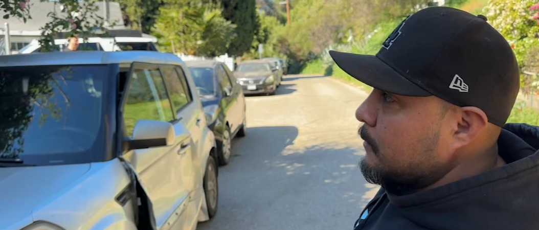 "When I turned my face that way