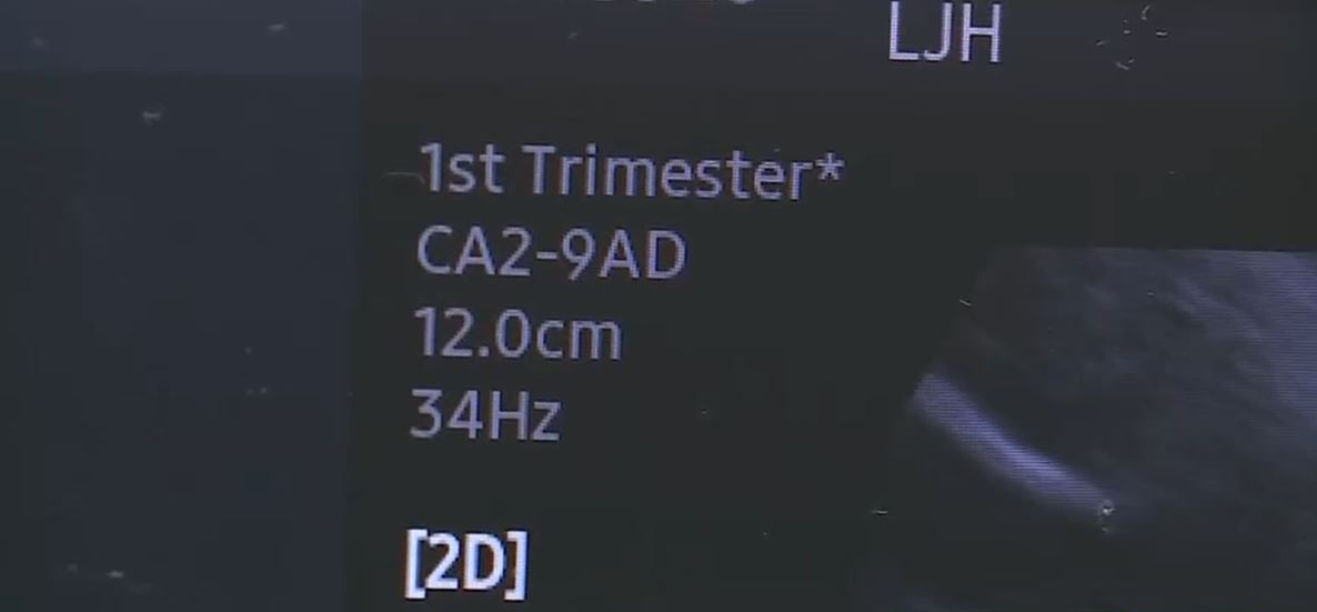 The initiative is part of Alabama's use of the $203 million awarded under the federal government's Rural Health Transformation Program