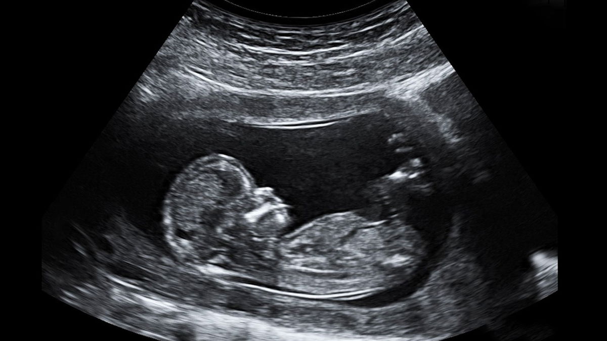 Wyoming Governor signs “Human Heartbeat Act” into law