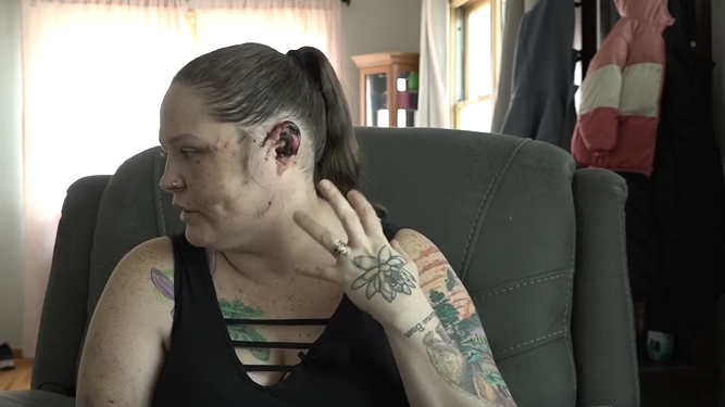 Mountain Home mom recovering after foster dog attack