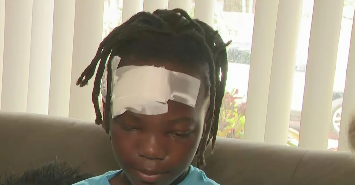 Johnny Baptiste Jr. and his family are speaking out after he was hit by a speeding car in Miami Gardens.