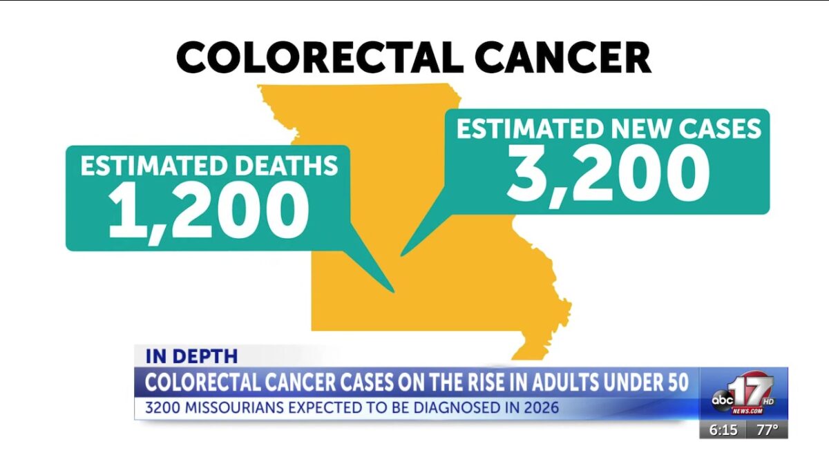 Too young for cancer: Colorectal cases surge to become top killer of younger adults