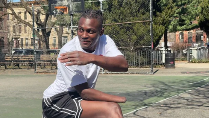 Ismael Ox lost his right had as a child in a grenade attack.