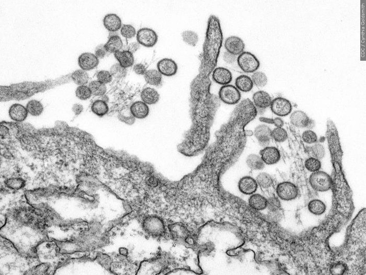 QUESTION OF THE DAY: Is the hantavirus outbreak getting the right amount of attention?
