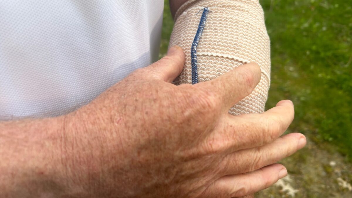 Standing with his left arm bandaged and stitched back together