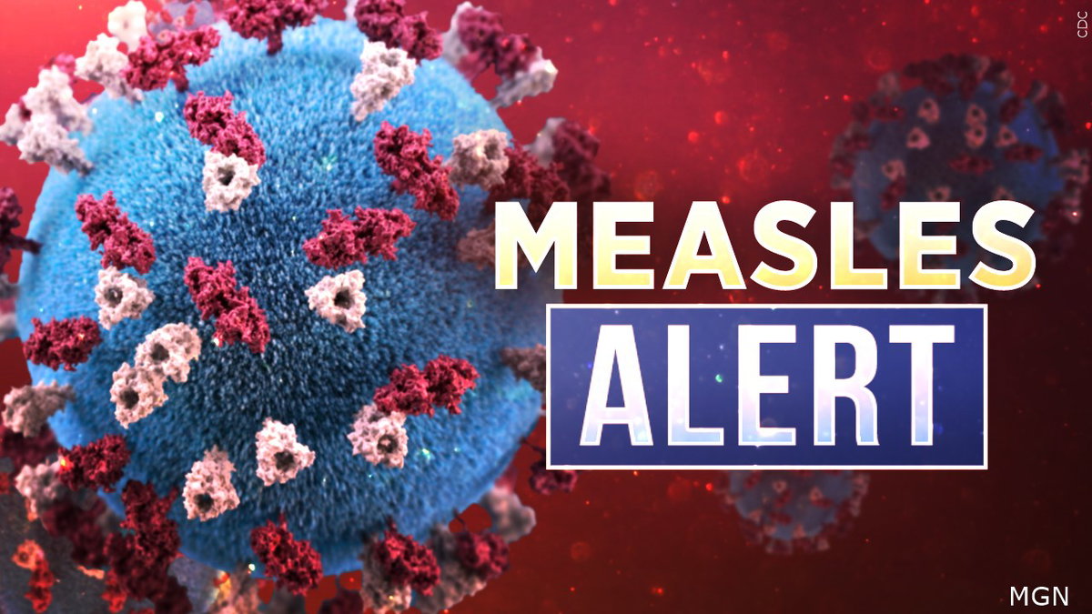 Second measles case confirmed in Wyoming; public exposure locations identified