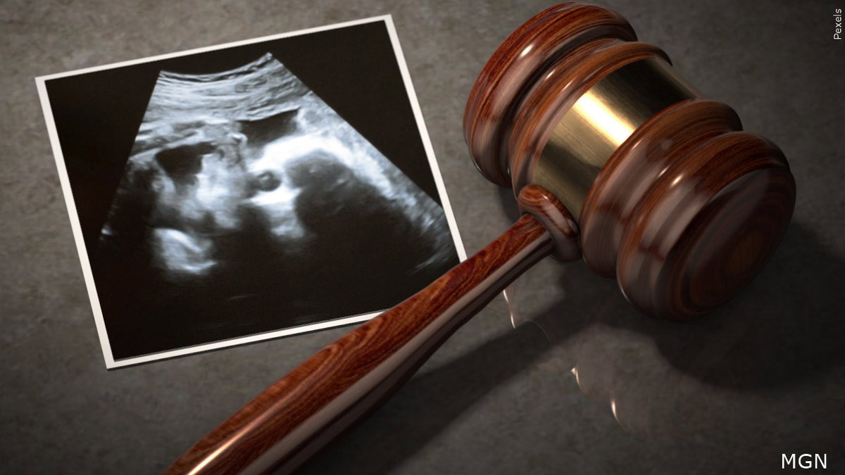 Judge rules Wyoming abortion ultrasound law unconstitutional