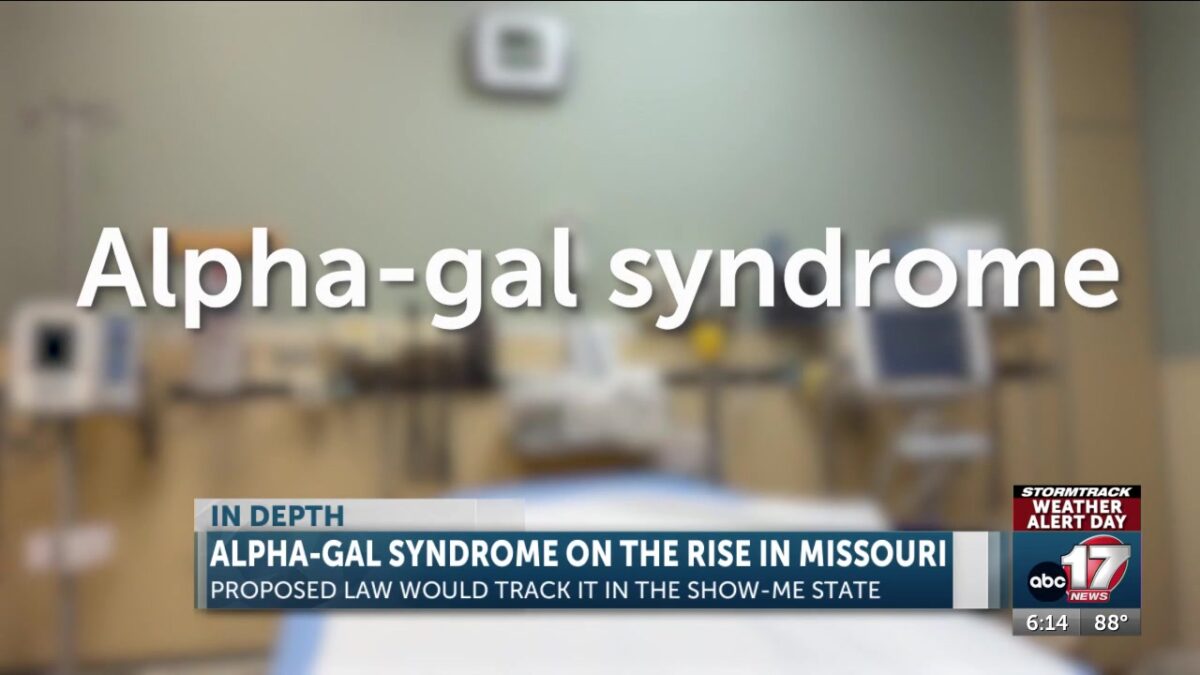 Thousands of Missourians could have alpha-gal syndrome