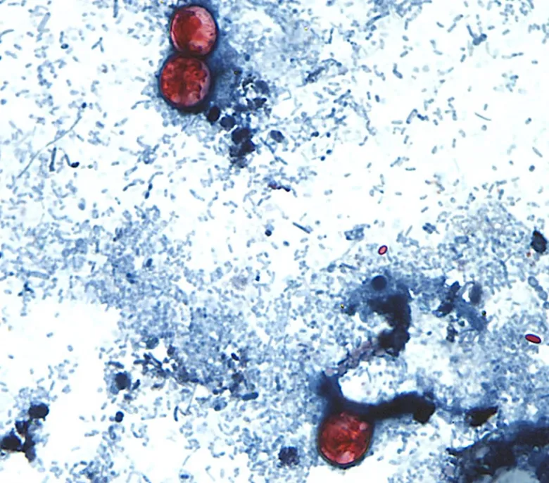 Parasite that causes explosive diarrhea detected in El Paso