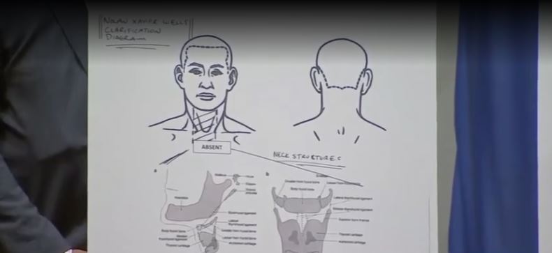 The investigation into the death of 18-year-old Nolan Wells continues as a second autopsy raises new questions about what happened before he entered the water.