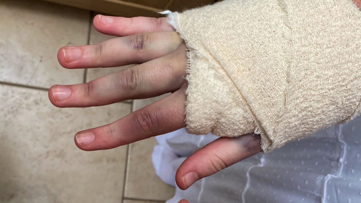After losing the use of her right hand following an injury and surgery