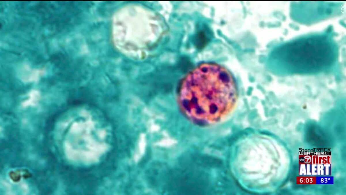 Food items to keep an eye on amid ‘explosive diarrhea’ parasite outbreak