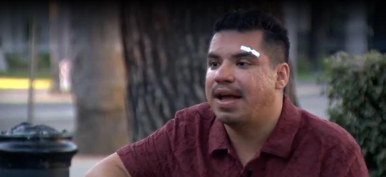 A Sacramento man said he was left bloodied and injured after four men shouted anti-LGBTQ and racist slurs