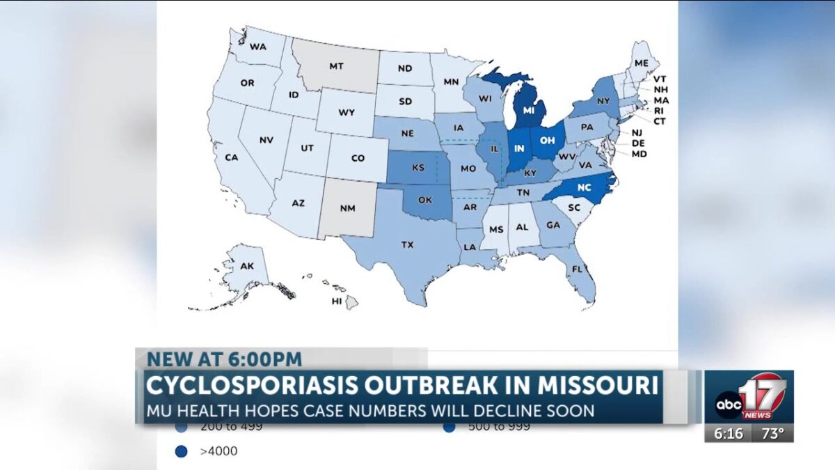 MU Health Care has treated 96 cyclosporiasis cases; doctor addresses new social media trend involving disease