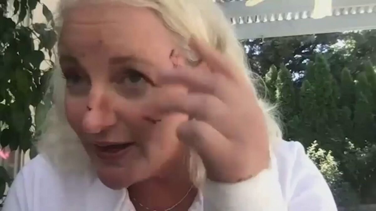 A woman who says she was attacked by an otter in a lake at Lake Tahoe