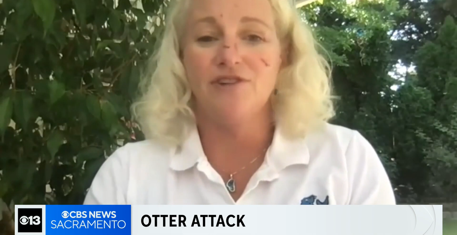 Lynnette Bellin said she was swimming near Hidden Beach in Incline Village when an otter attacked her underwater.