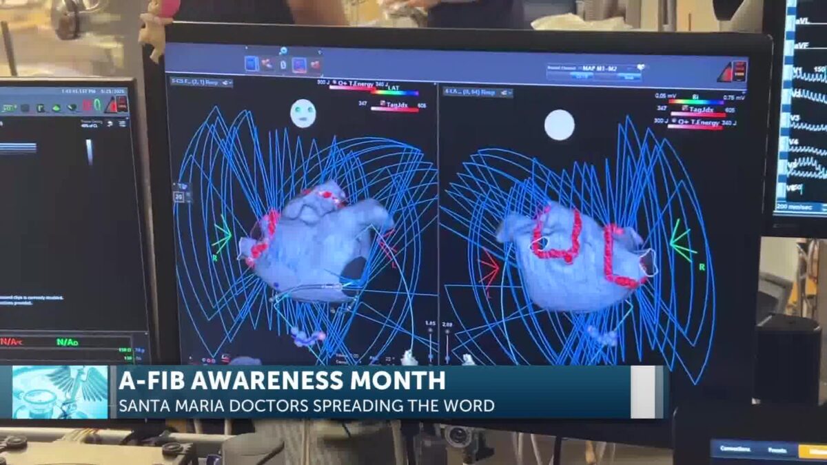 Santa Maria Doctors Seeing Rise In Cases During AFib Awareness Month