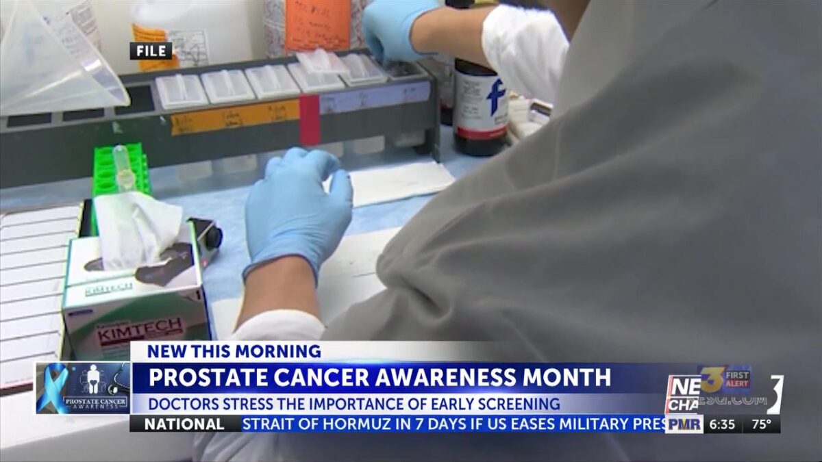 Desert Regional doctor highlights prostate cancer screening during Awareness Month