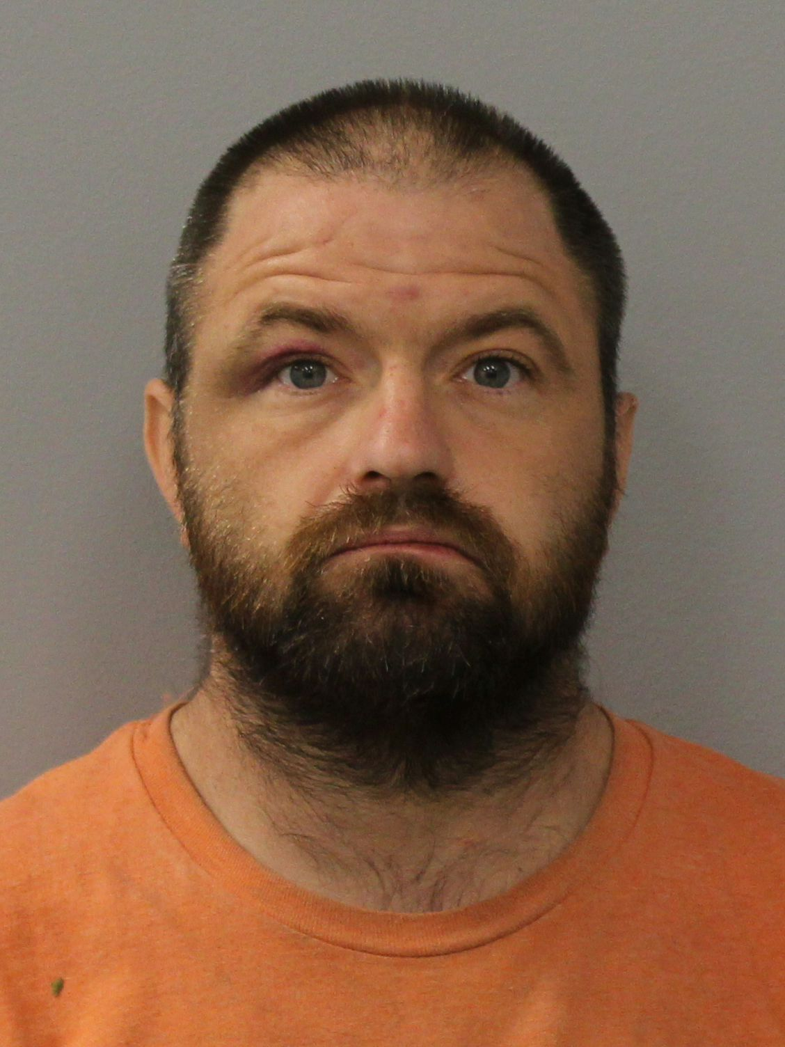 Man charged after allegedly using fence post to seriously injure victim in Rolla