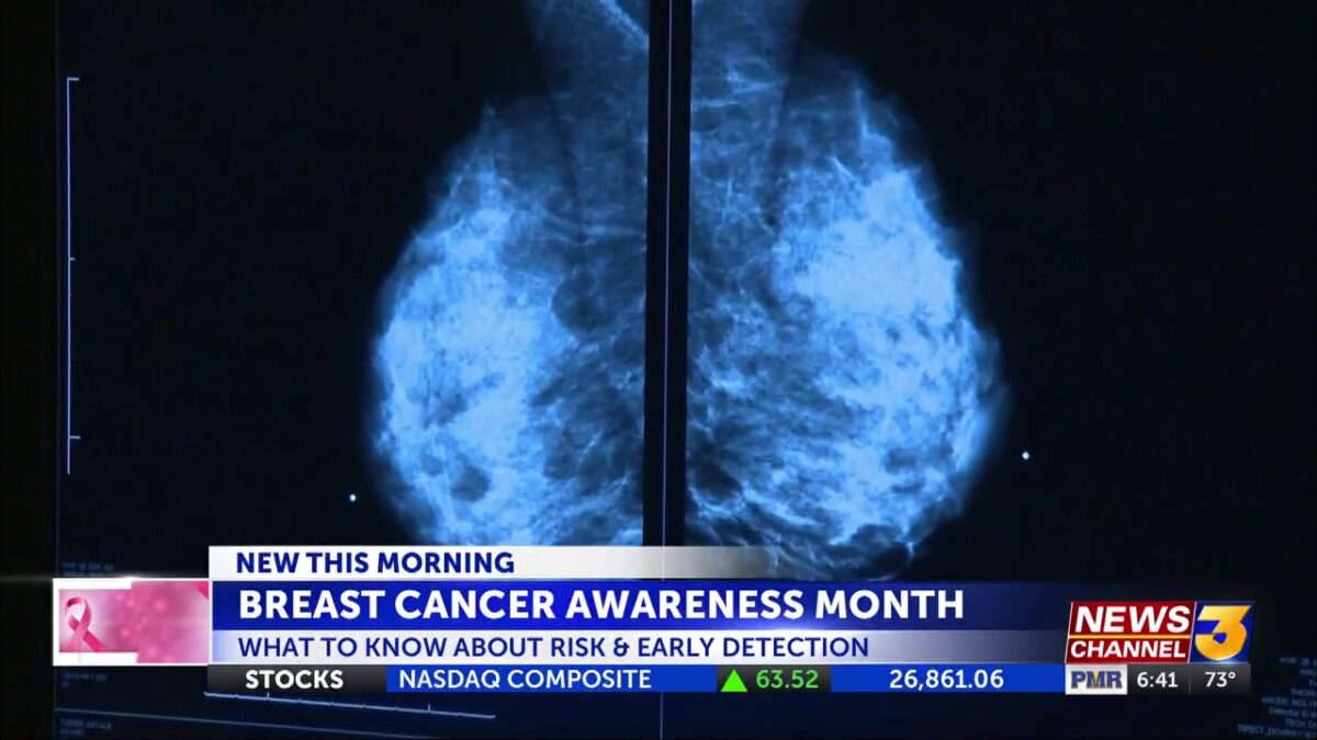 Breast Cancer Awareness Month: what to know about screening