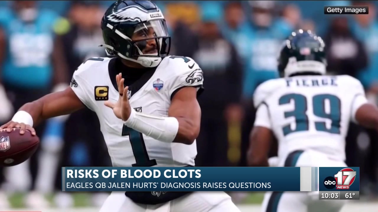 Jalen Hurts’ blood clot diagnosis raises questions about travel